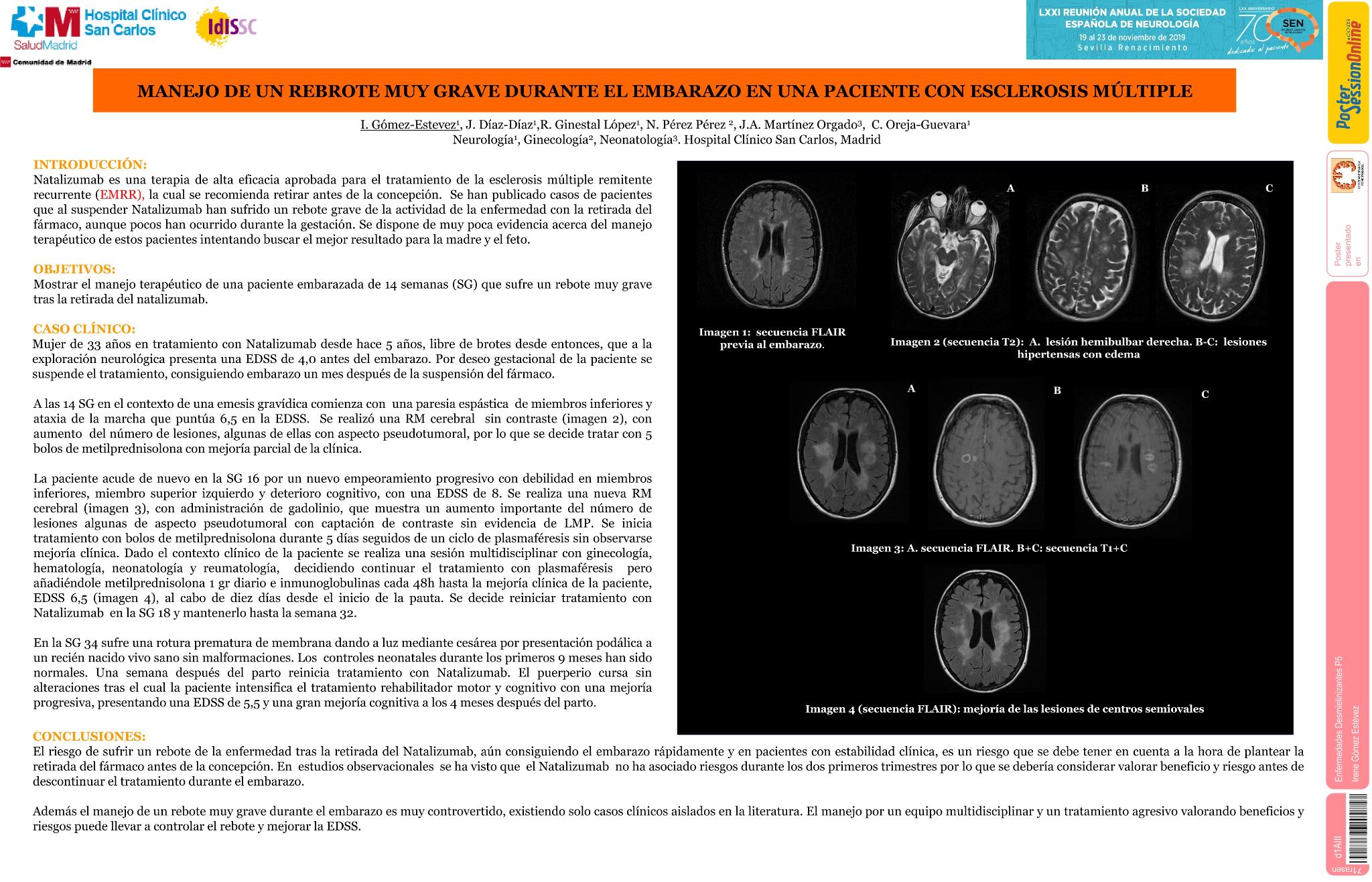 Manejo de un rebrote muy grave durante el embarazo en una paciente con Esclerosis Múltiple