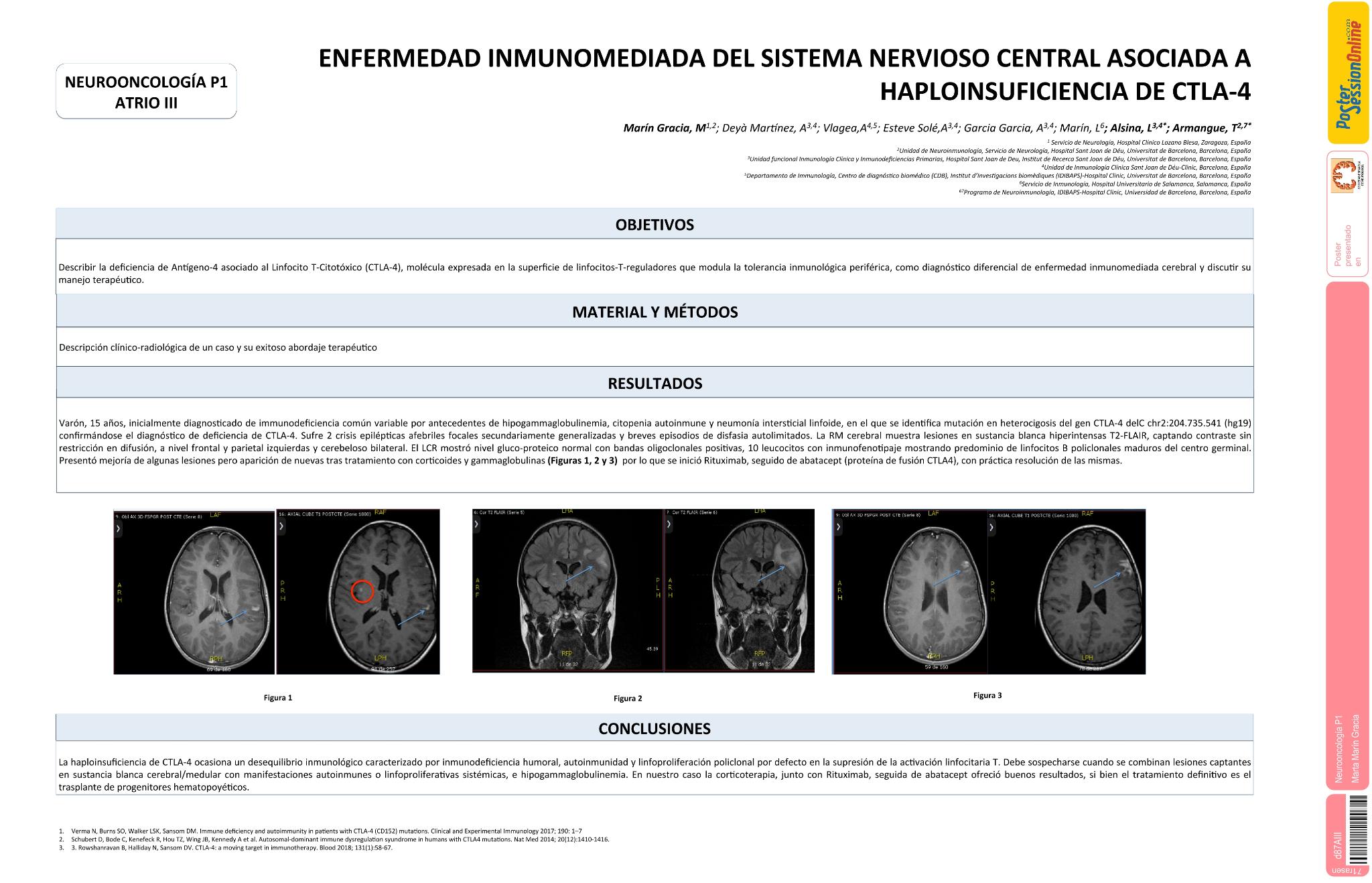 Enfermedad inmunomediada del sistema nervioso central asociada a haploinsuficiencia de CTLA-4