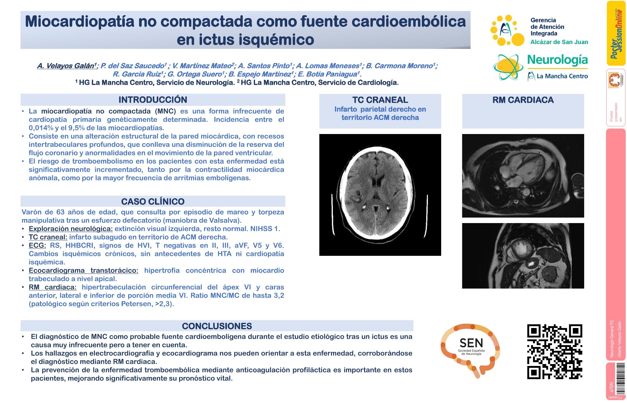 Miocardiopatía no compactada como fuente cardioembólica en ictus isquémico