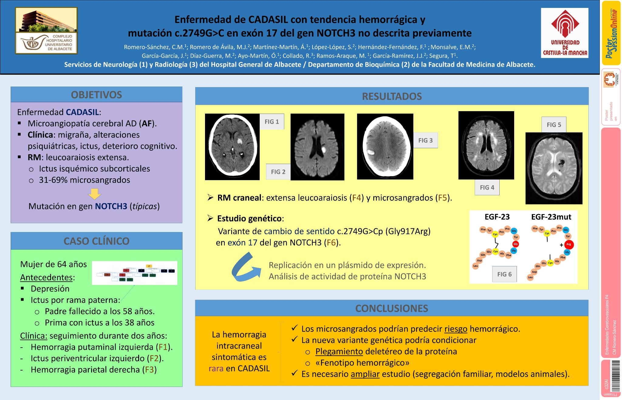 Enfermedad de CADASIL con tendencia hemorrágica y mutación c.2749G>Cp.(Gly917Arg) en exón 17 del gen NOTCH3 no descrita previamente