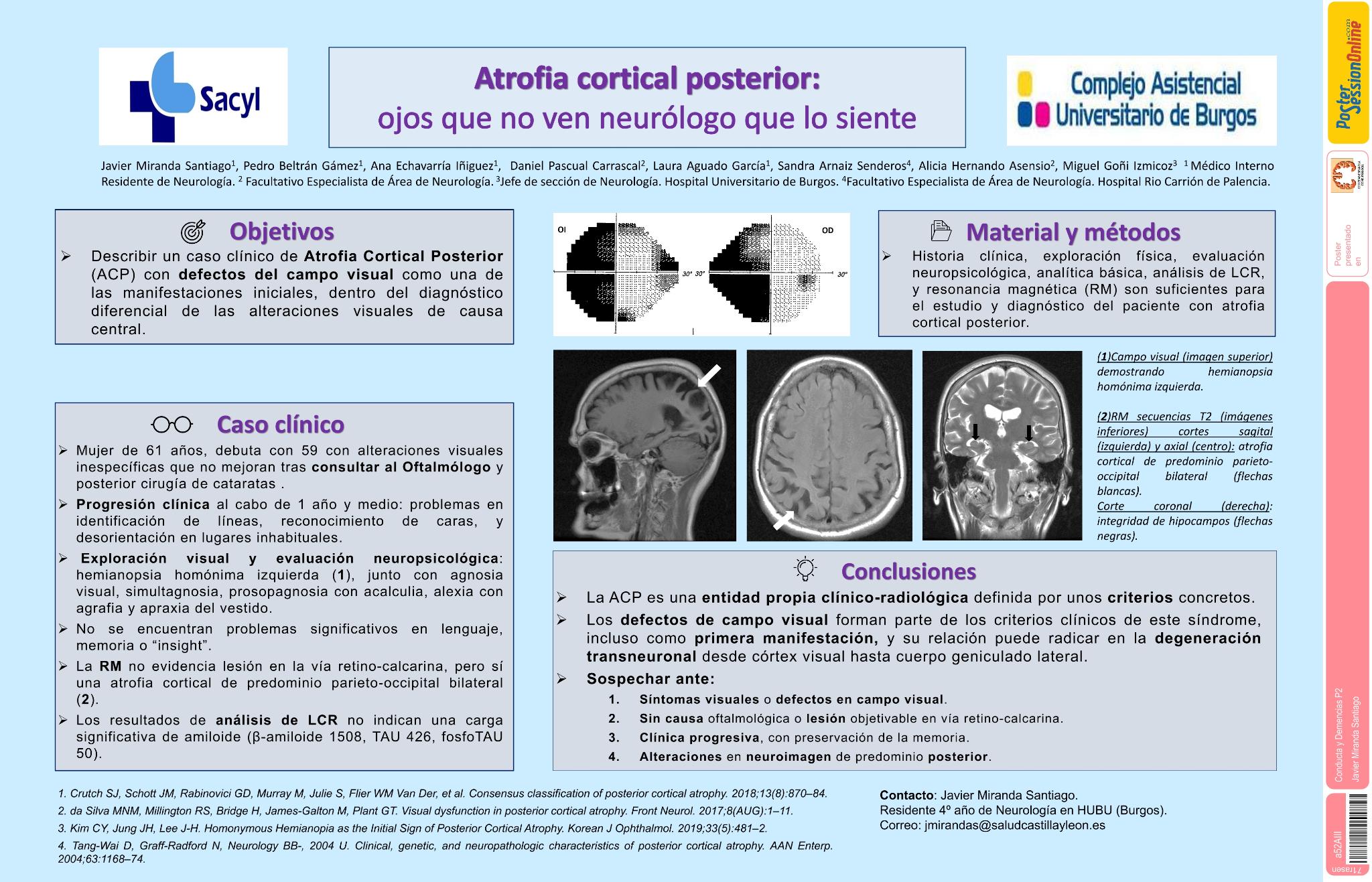 Atrofia cortical posterior: ojos que no ven neurólogo que lo siente