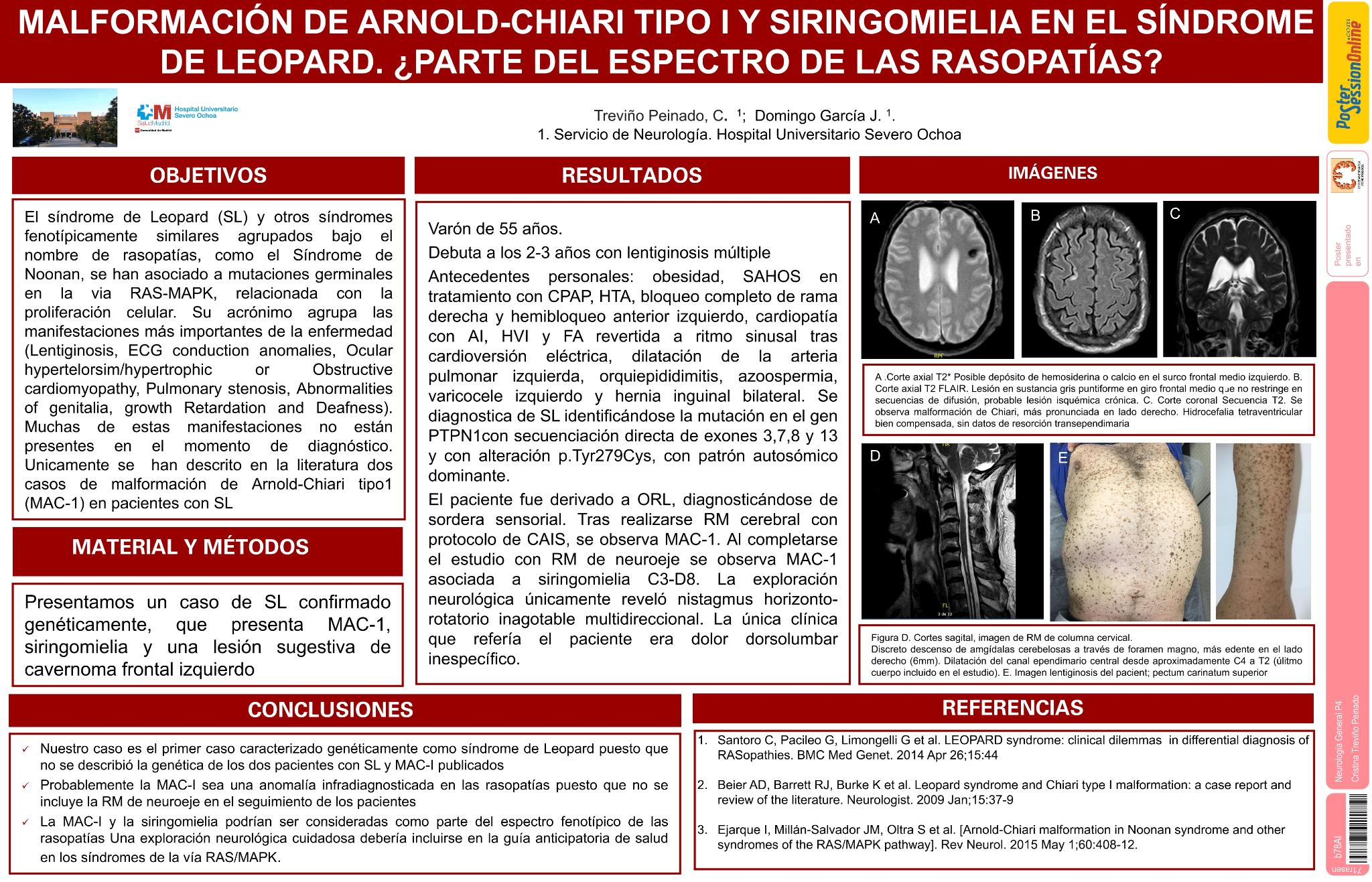 Malformación de Arnold Chiari y siringomielia en el síndrome de Leopard. ¿Parte del espectro de las rasopatias?