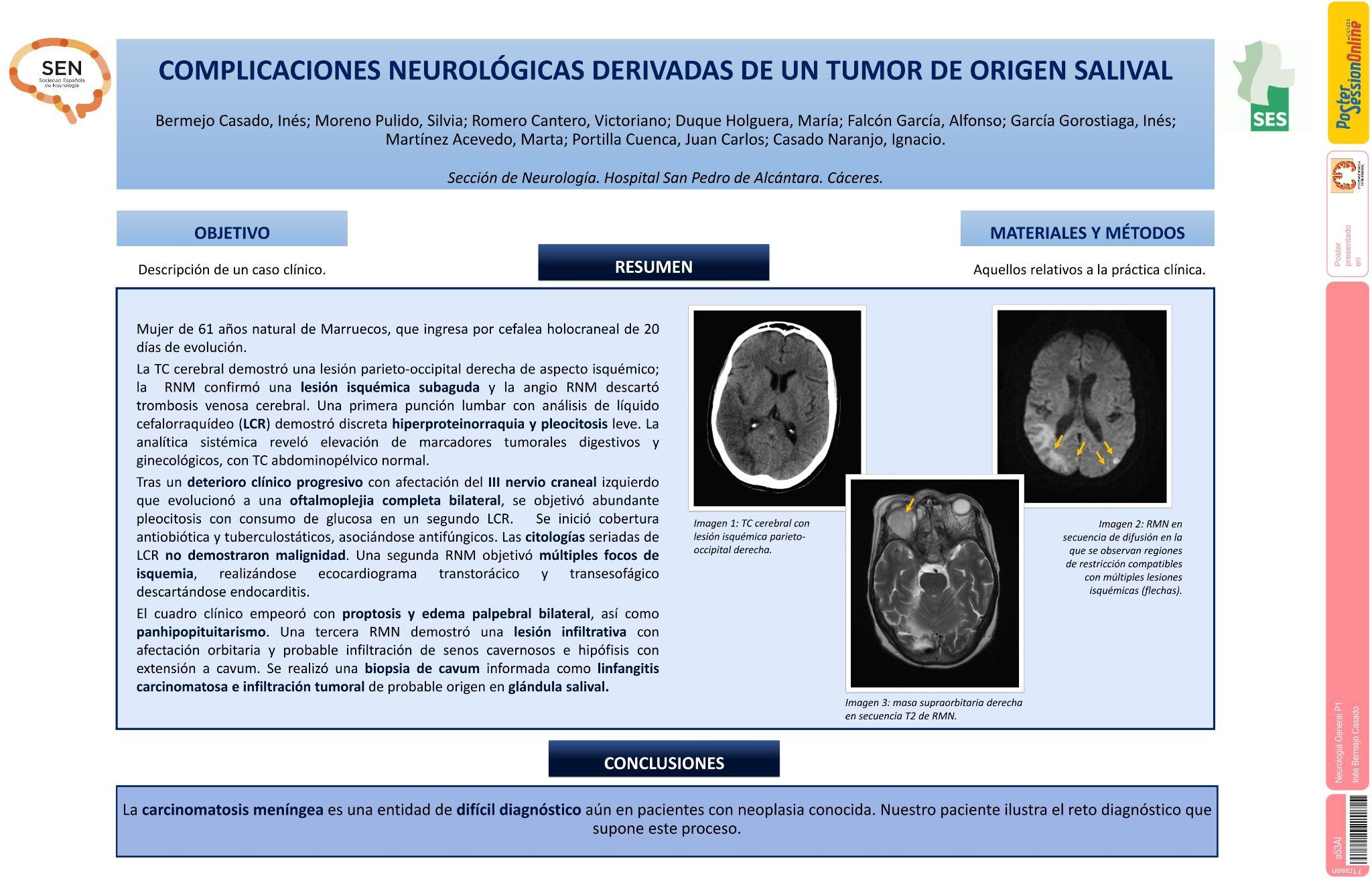 Complicaciones neurológicas derivadas de un tumor de origen salival