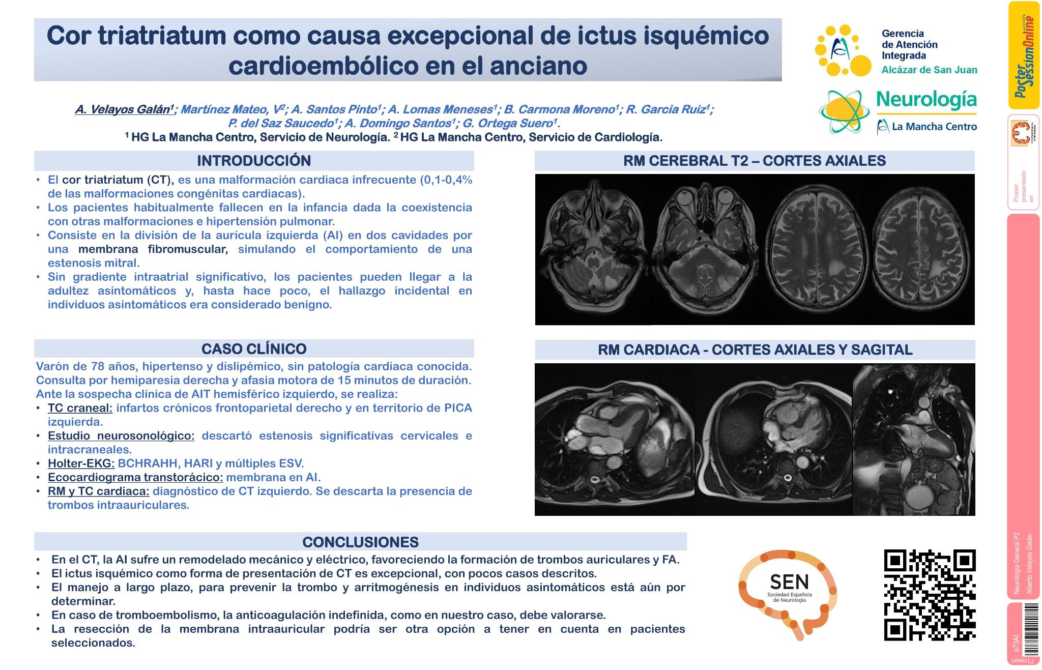 Cor triatriatum como causa excepcional de ictus isquémico cardioembólico en el anciano