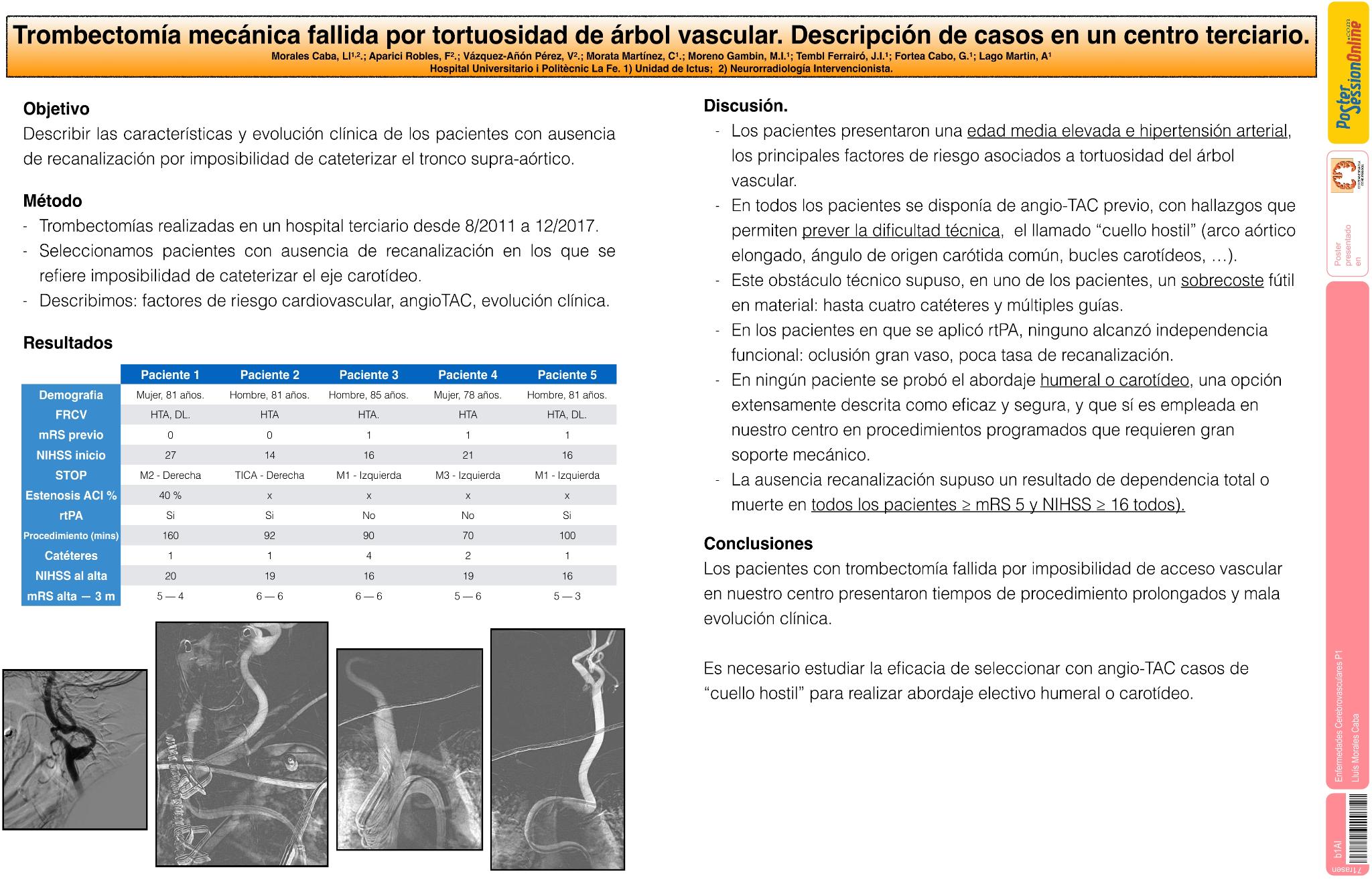 Trombectomía mecánica fallida por tortuosidad de árbol vascular. Descripción de casos en un centro terciario