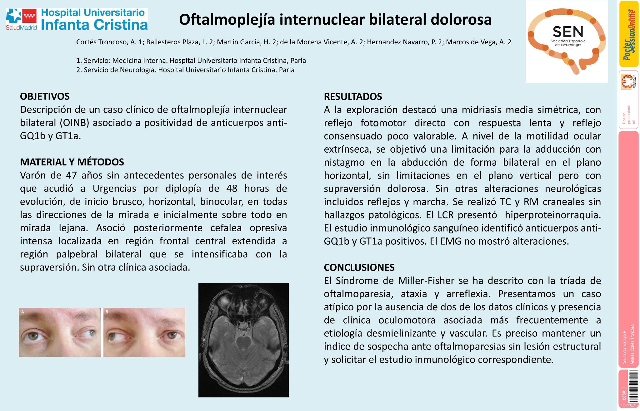 Oftalmoplejía internuclear bilateral dolorosa