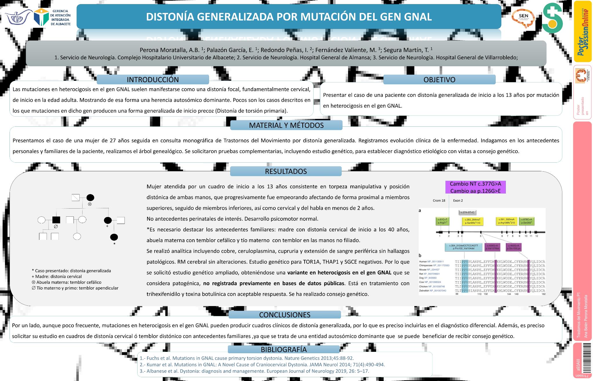 Distonía generalizada por mutación en heterocigosis del gen GNAL