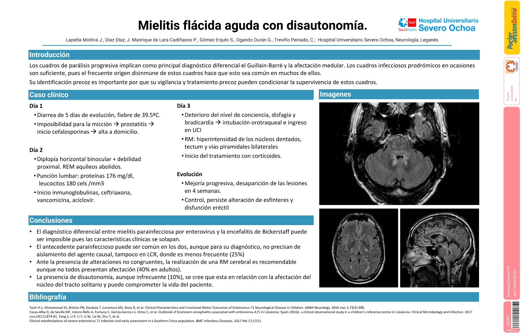 Mielitis flácida aguda con afectación autonómica