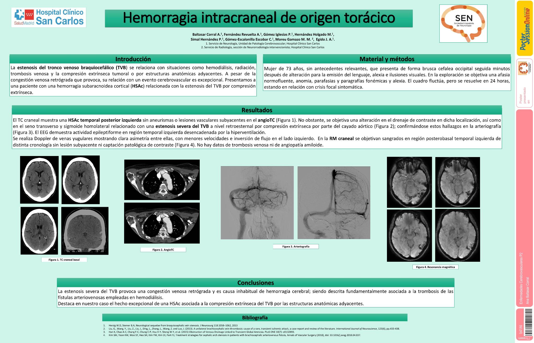 Hemorragia intracraneal de origen torácico