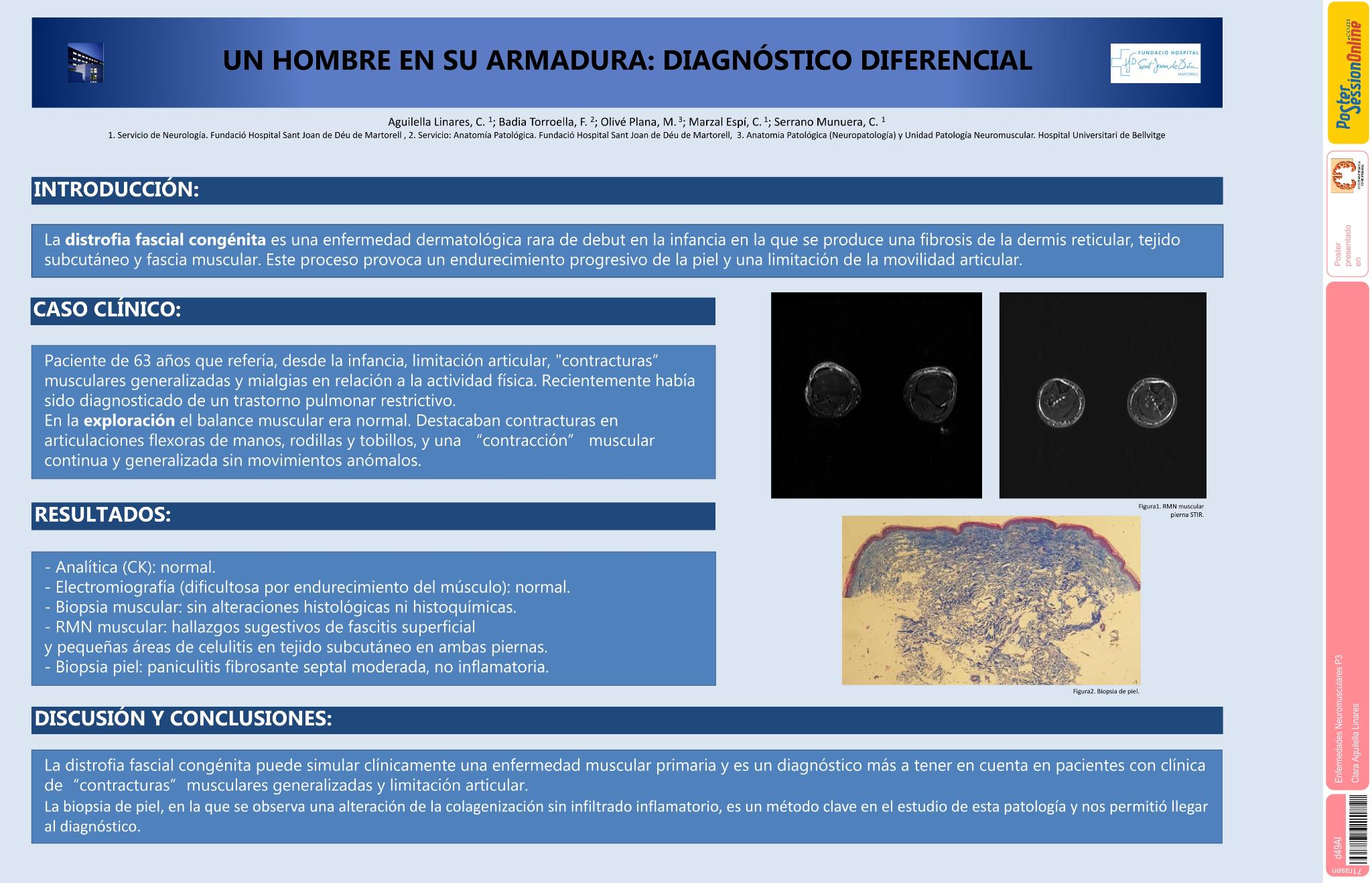 Un hombre en su armadura: diagnóstico diferencial