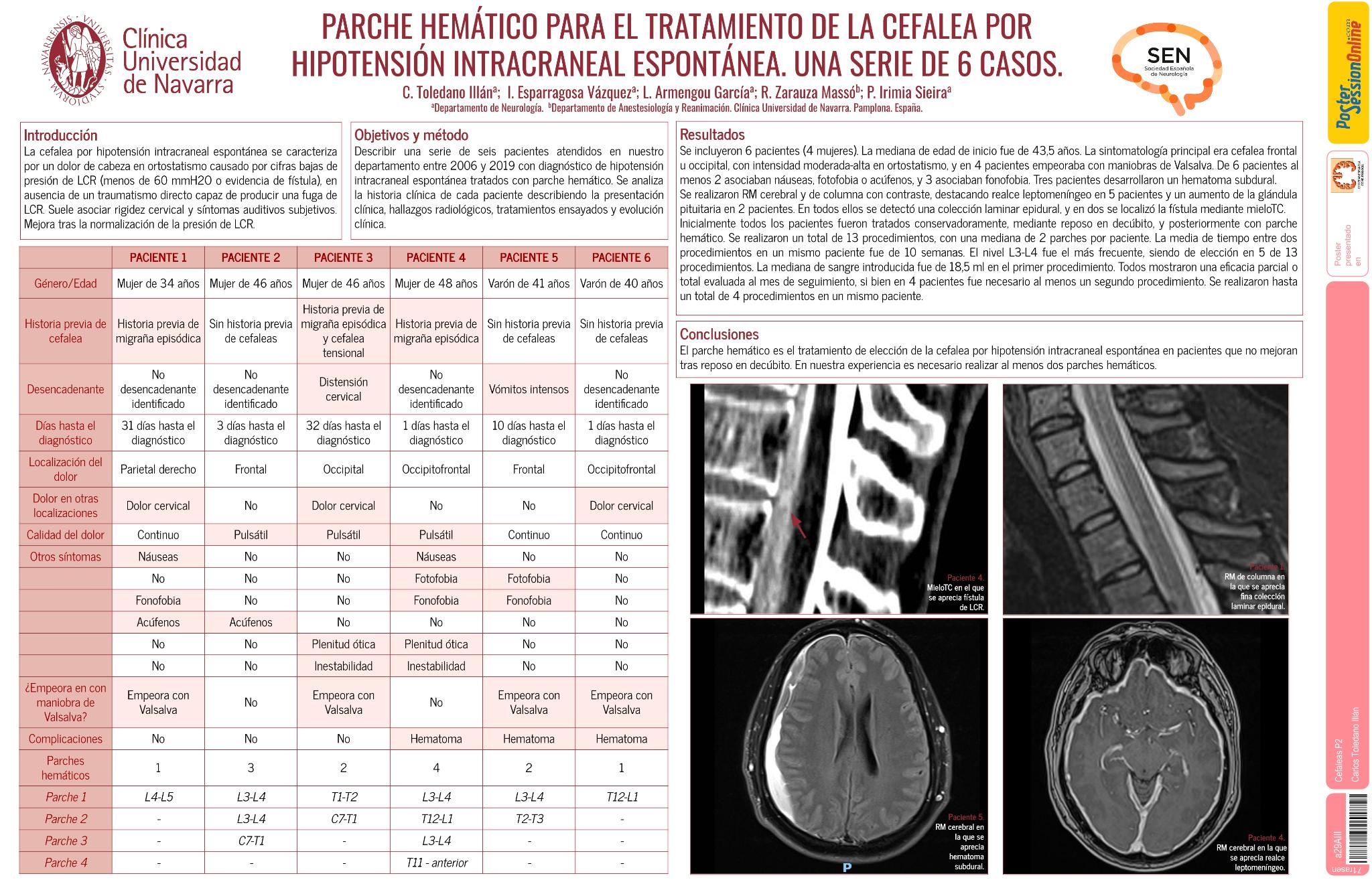 Parche hemático para el tratamiento de la cefalea por hipotensión intracraneal espontánea. Una serie de 6 casos