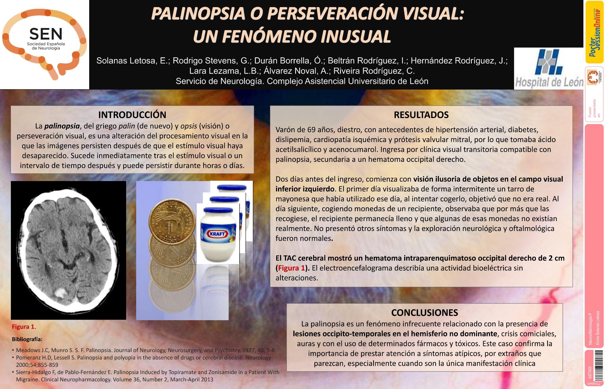 Palinopsia o perseveración visual: un fenómeno inusual