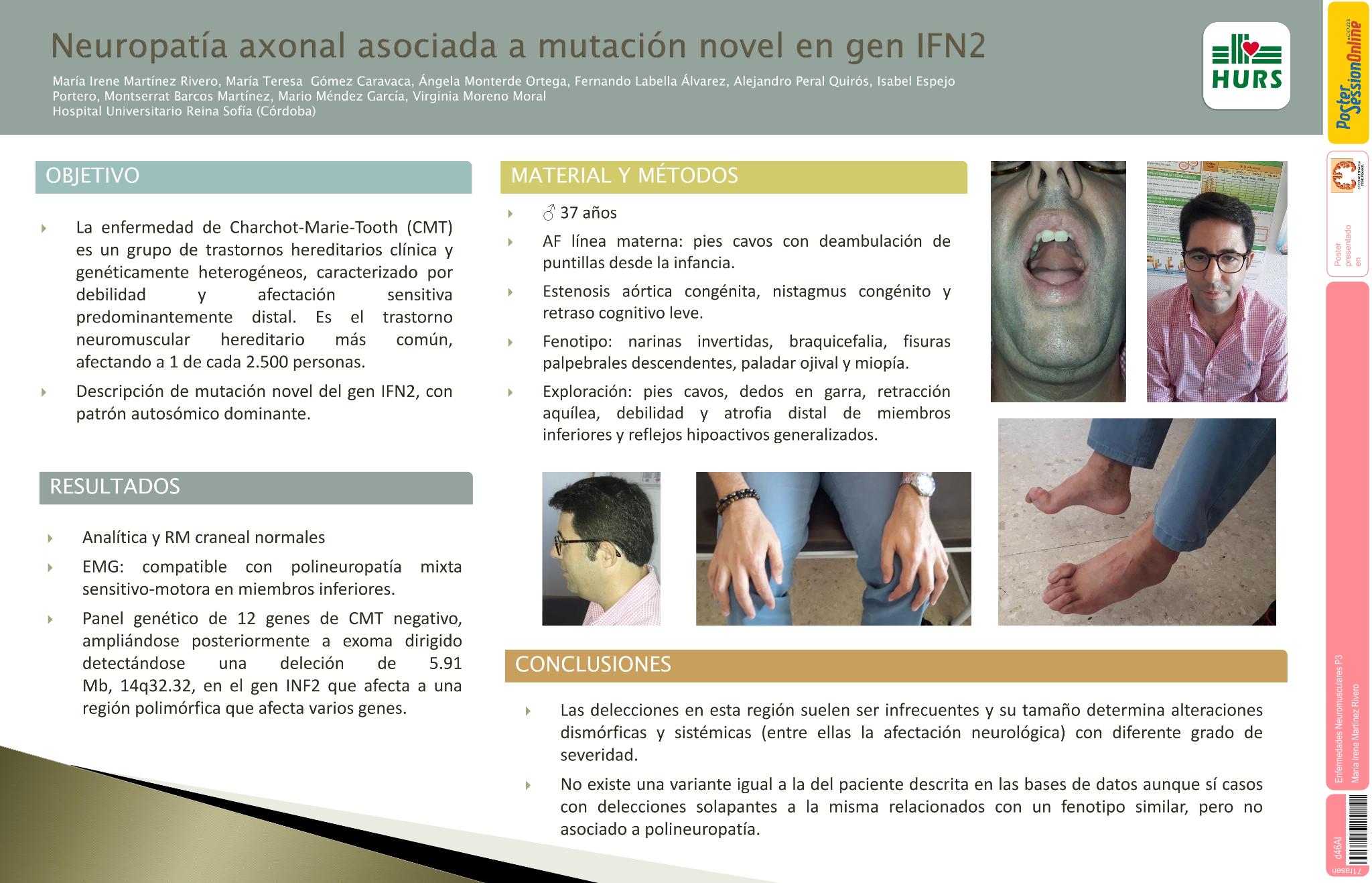 Neuropatía axonal asociada a mutación novel en gen IFN2