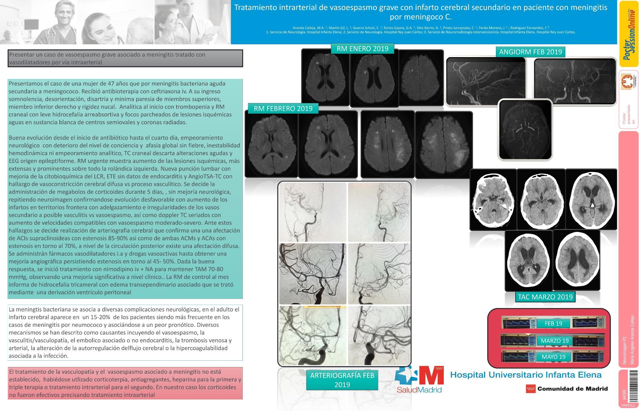Tratamiento intrarterial de vasoespasmo grave con infarto cerebral secundario en paciente con meningitis por meningoco C