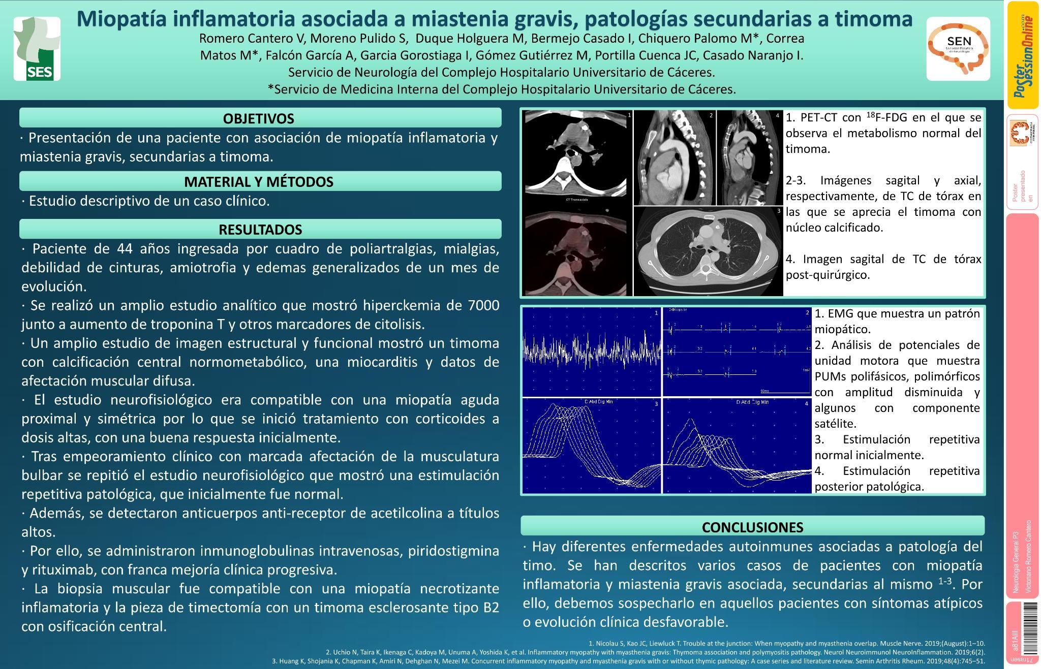 Miopatía inflamatoria asociada a miastenia gravis, patologías asociadas a timoma