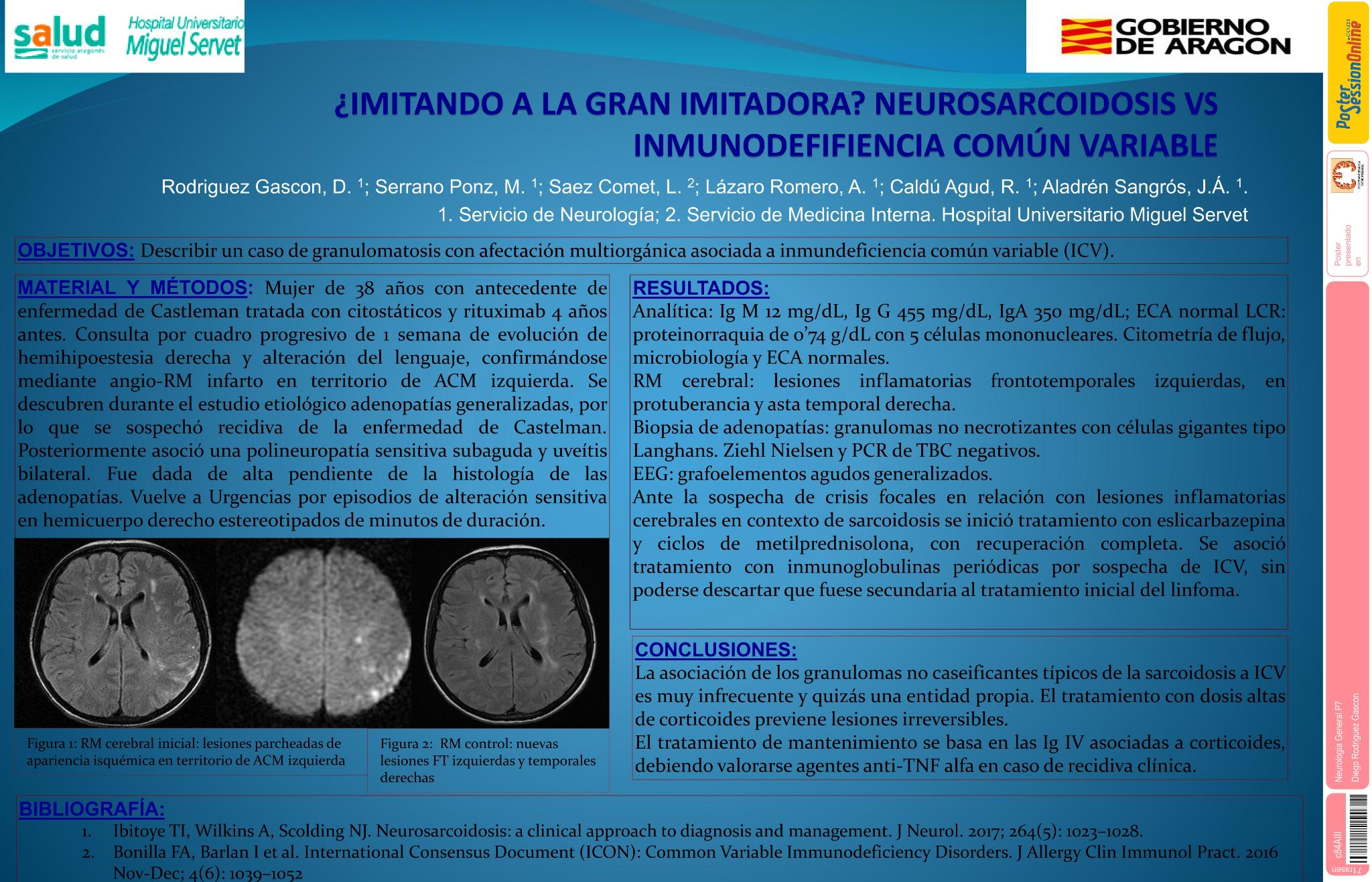 ¿Imitando a la gran imitadora? Neurosarcoidosis vs inmunodeficiencia común variable
