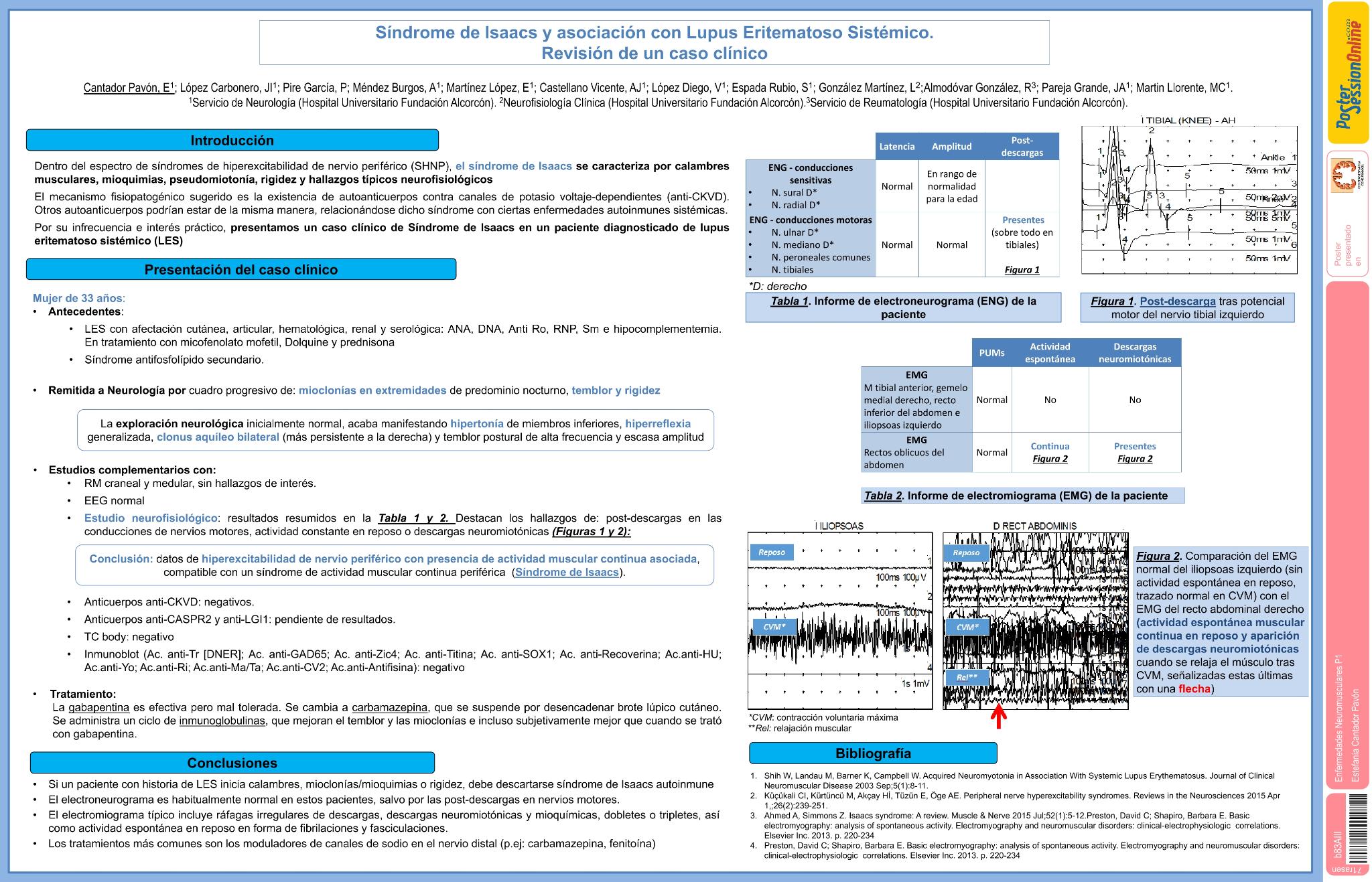 Síndrome de Isaacs y asociación con Lupus Eritematoso Sistémico. Revisión de un caso clínico