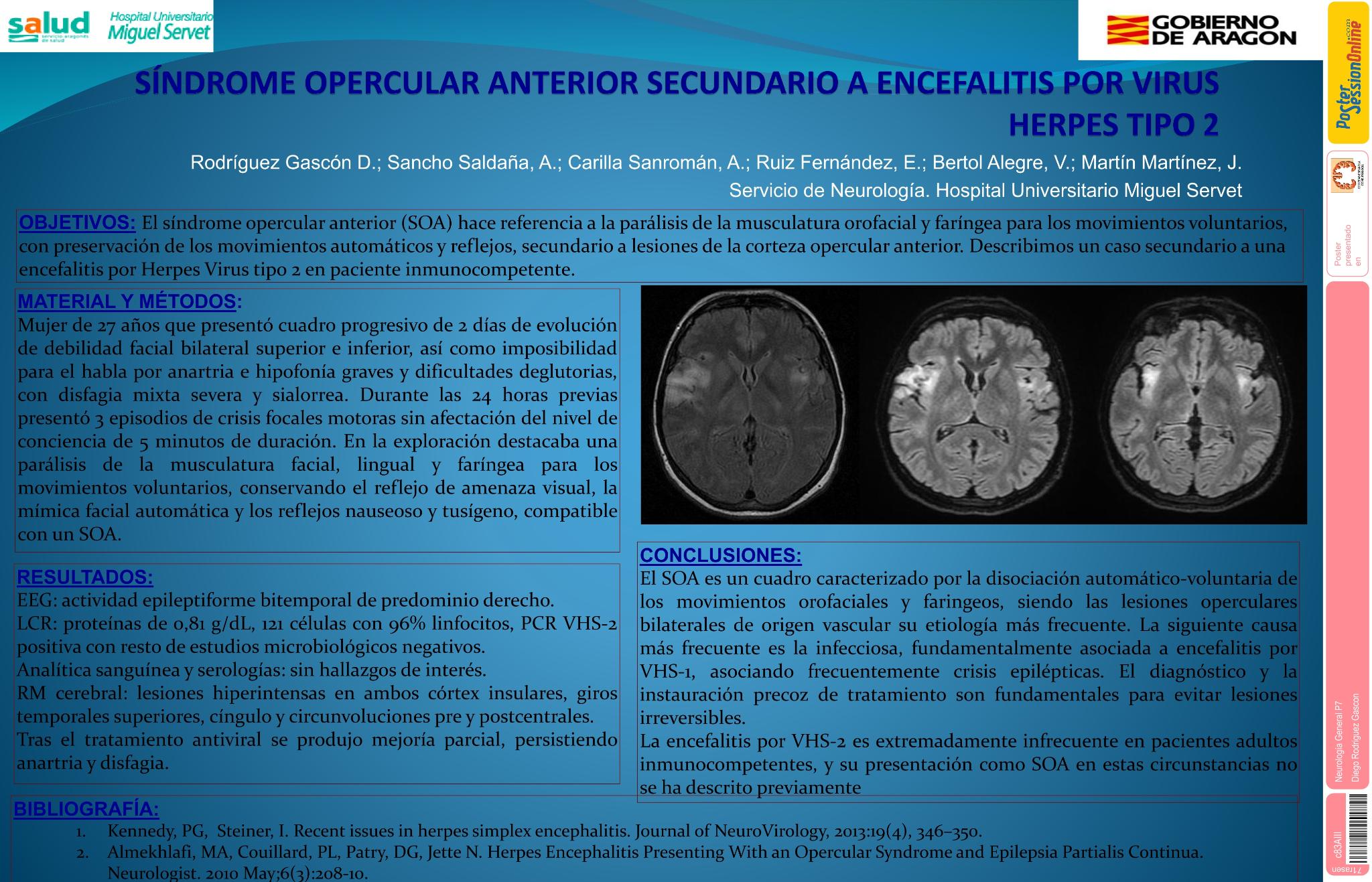 Síndrome opercular anterior secundario a encefalitis por Herpes Virus Tipo 2