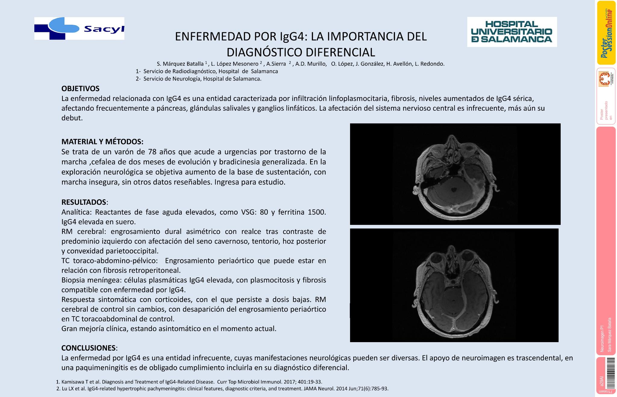 Enfermedad por IGG4: la importancia del diagnóstico diferencial