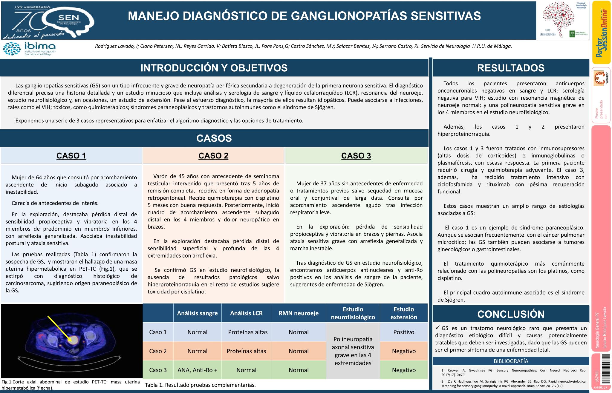 Manejo diagnóstico de ganglionopatías sensitivas