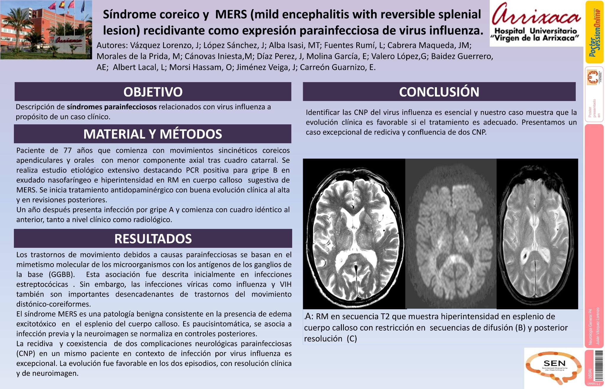 Síndrome Coreico y  MERS (Mild Encephalitis with Reversible Splenial lesion) recidivante como expresión parainfecciosa de virus influenza