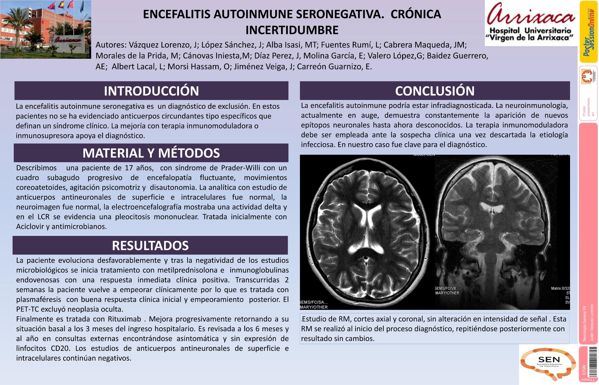 Encefalitis autoinmune seronegativa. Crónica incertidumbre