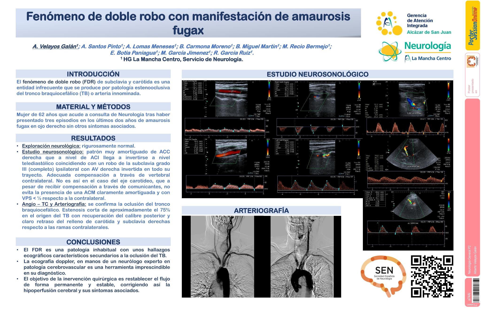 Fenómeno de doble robo con manifestación de amaurosis fugax