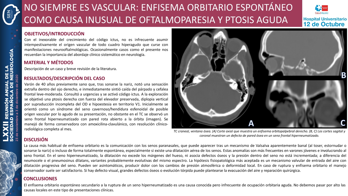 No siempre es vascular: enfisema orbitario espontáneo como causa inusual de oftalmoparesia y ptosis aguda