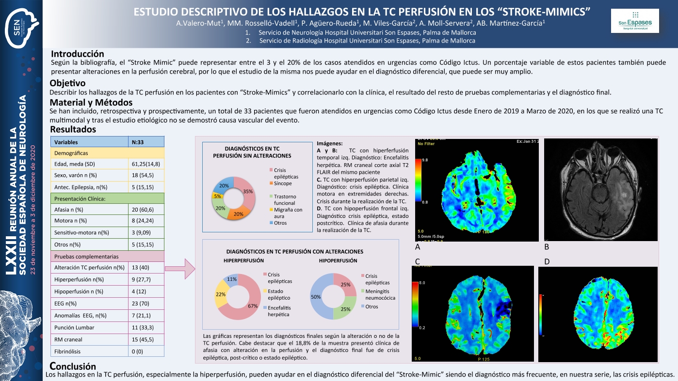 ESTUDIO DESCRIPTIVO DE LOS HALLAZGOS EN LA TC PERFUSIÓN EN LOS "STROKE-MIMICS"