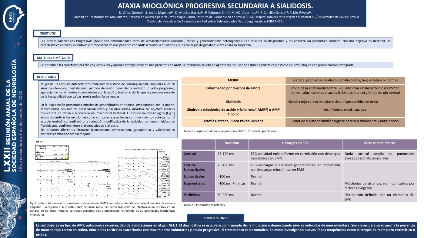 Ataxia Mioclónica Progresiva secundaria a Sialidosis