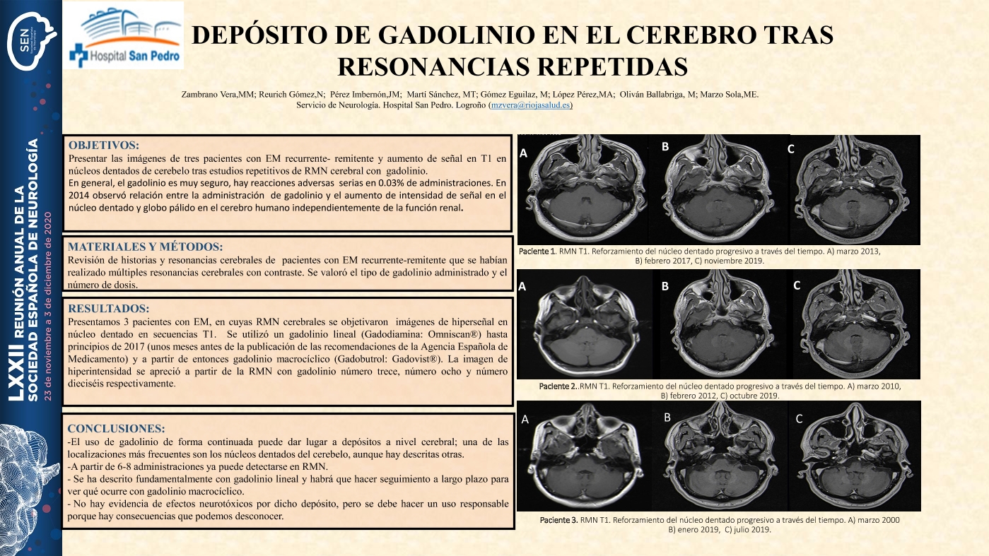Depósito de gadolinio en el cerebro tras Resonancias repetidas.