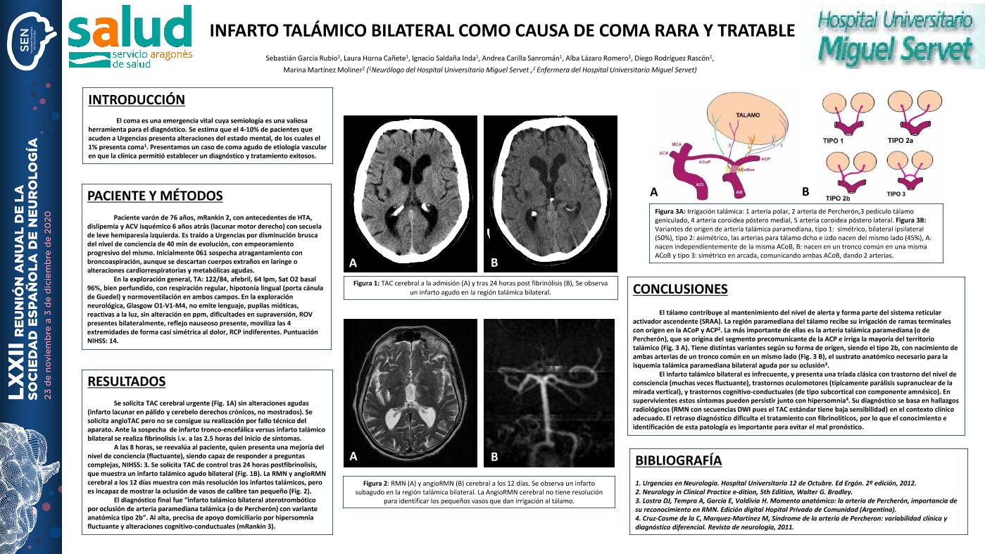 Infarto talámico bilateral como causa de coma rara y tratable