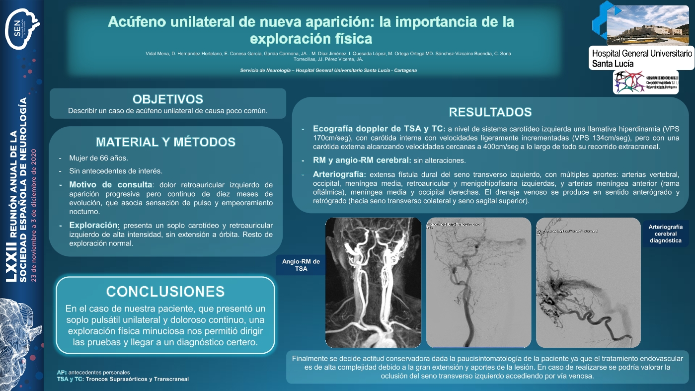 Acúfeno unilateral de nueva aparición: la importancia de la exploración física.