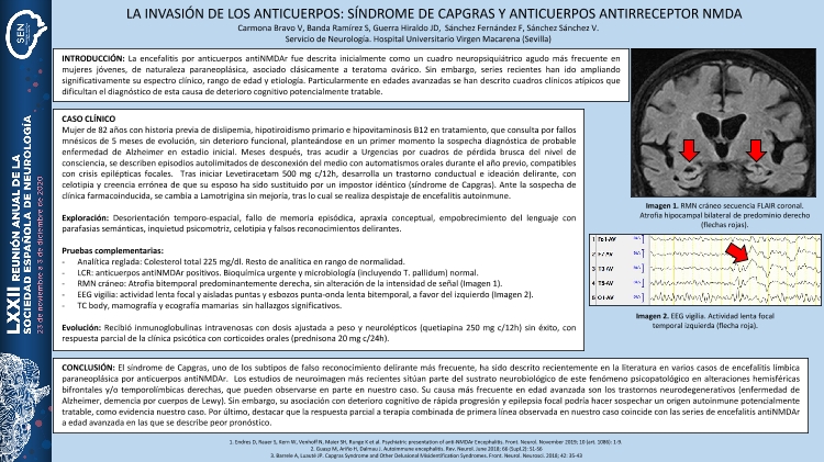 La invasión de los anticuerpos: síndrome de Capgras y anticuerpos antirreceptor NMDA