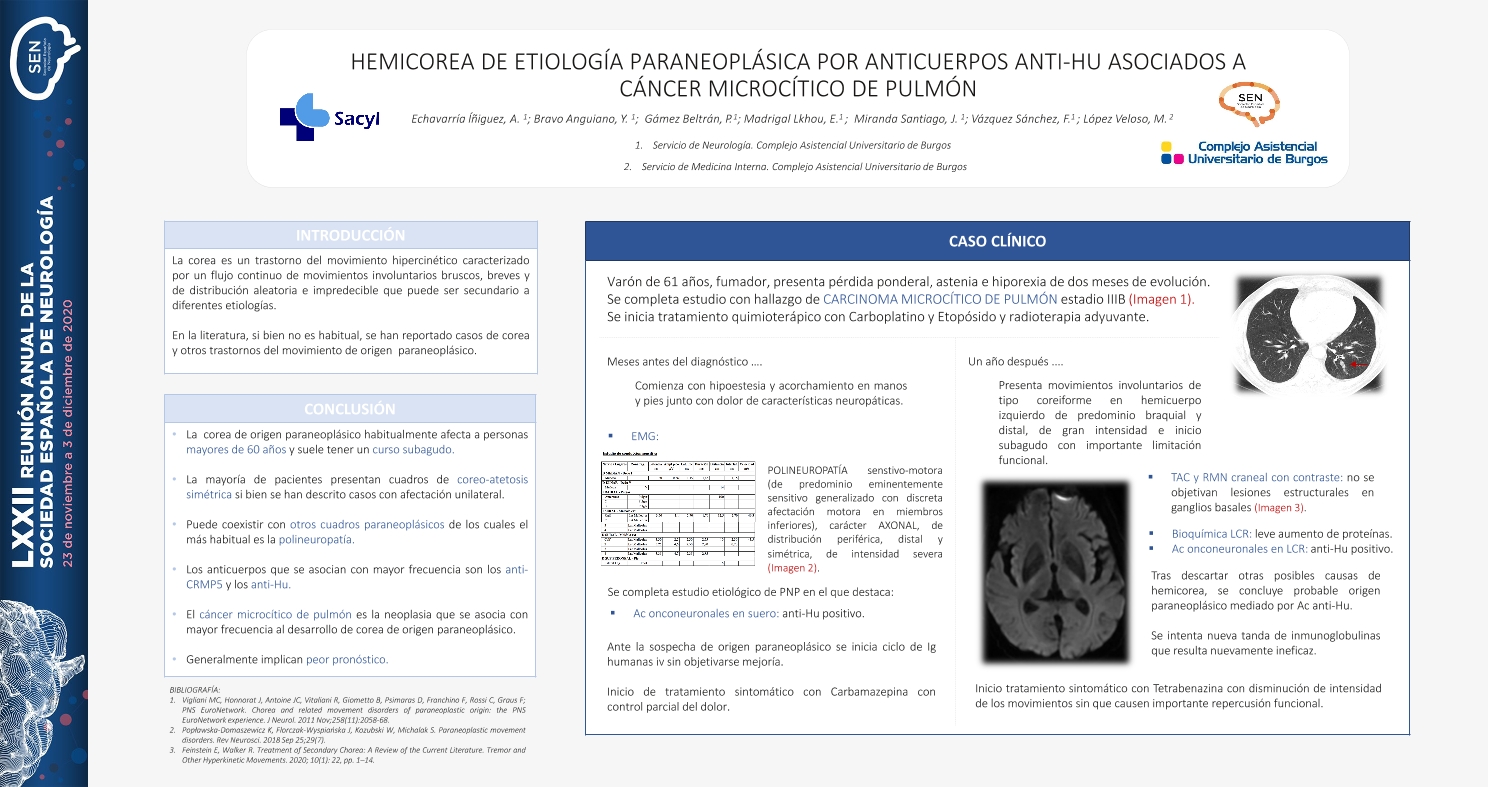 Hemicorea de etiología paraneoplásica por anticuerpos anti-Hu asociados a cáncer microcítico de pulmón