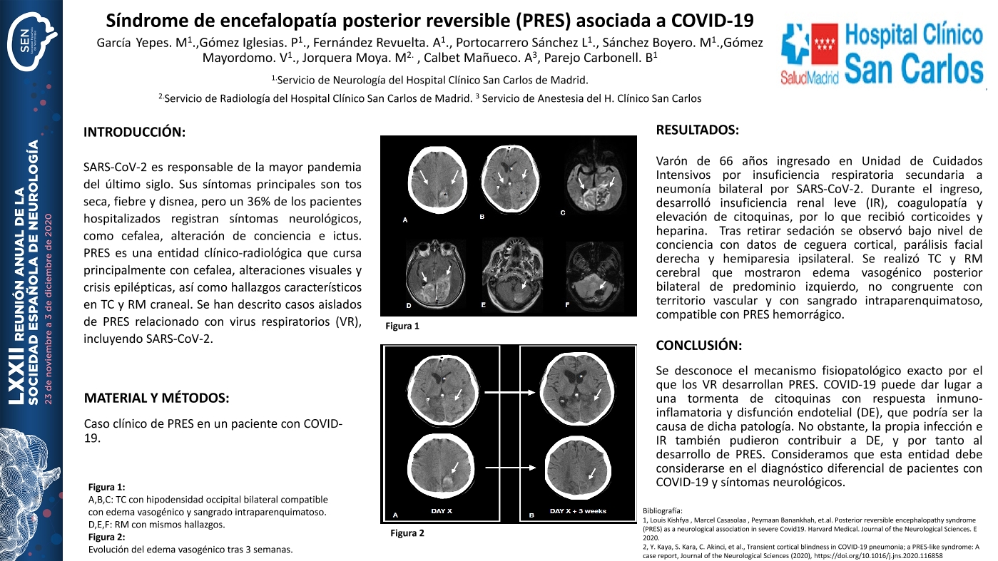 Síndrome de encefalopatía posterior reversible (PRES) asociada a COVID-19