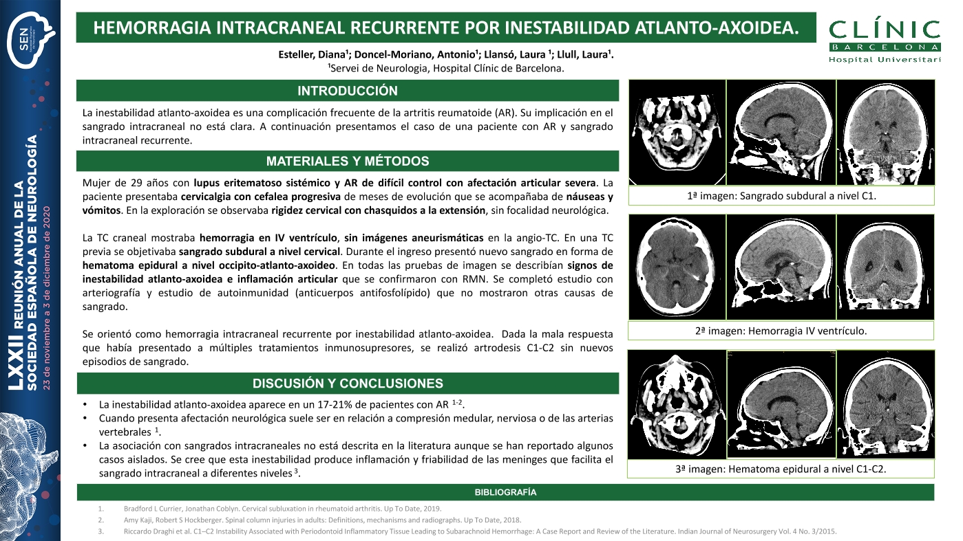 Hemorragia intracraneal recurrente por inestabilidad atlanto-axoidea.