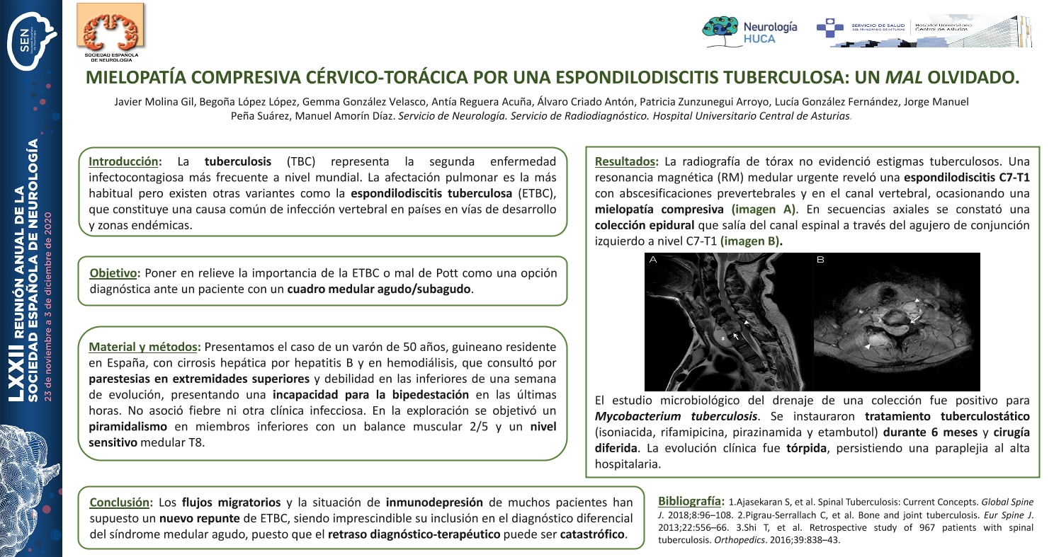 Mielopatía compresiva cervico-torácica por una espondilodiscitis tuberculosa: un mal olvidado.