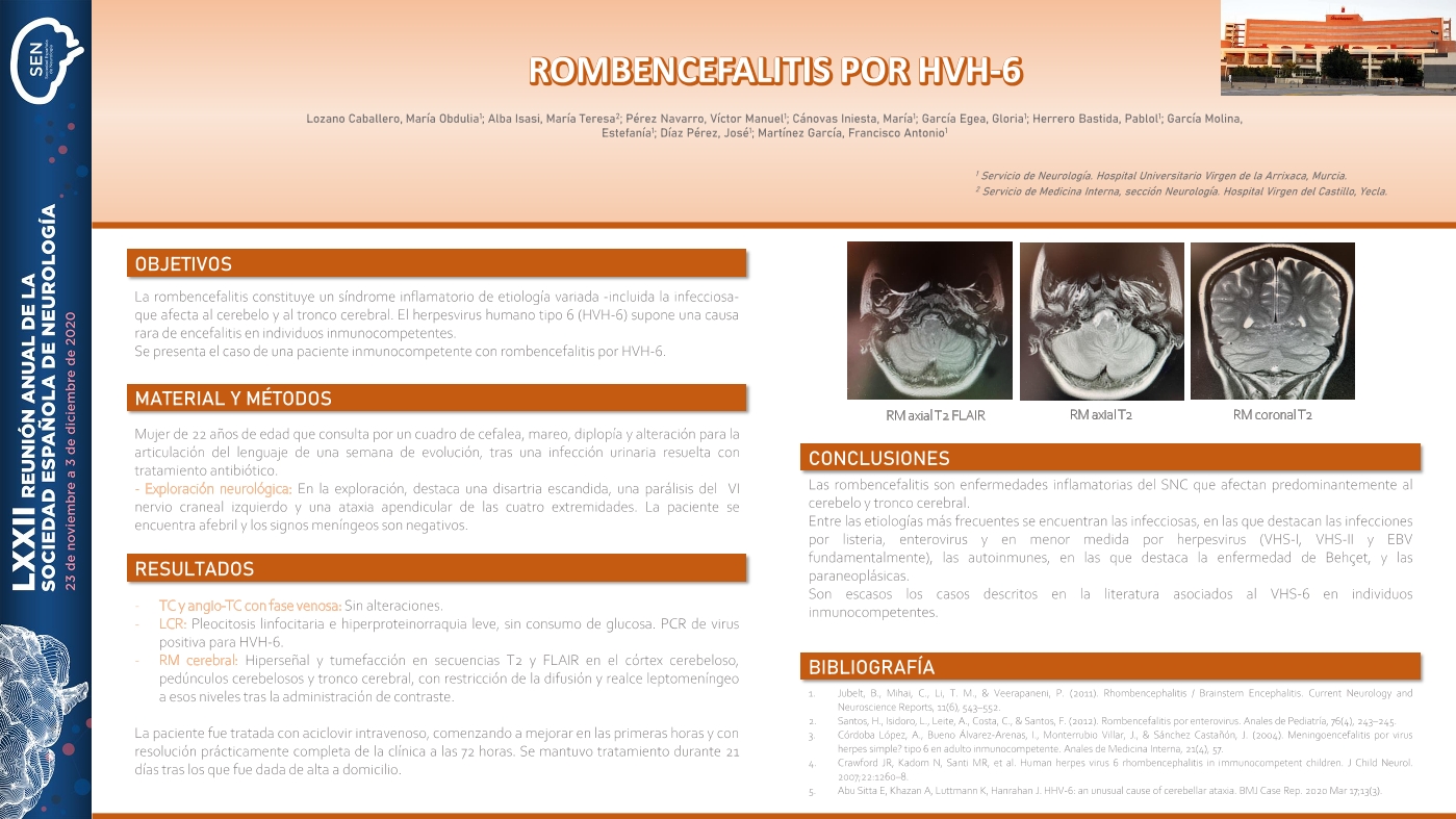 Rombencefalitis por herpesvirus humano tipo 6.