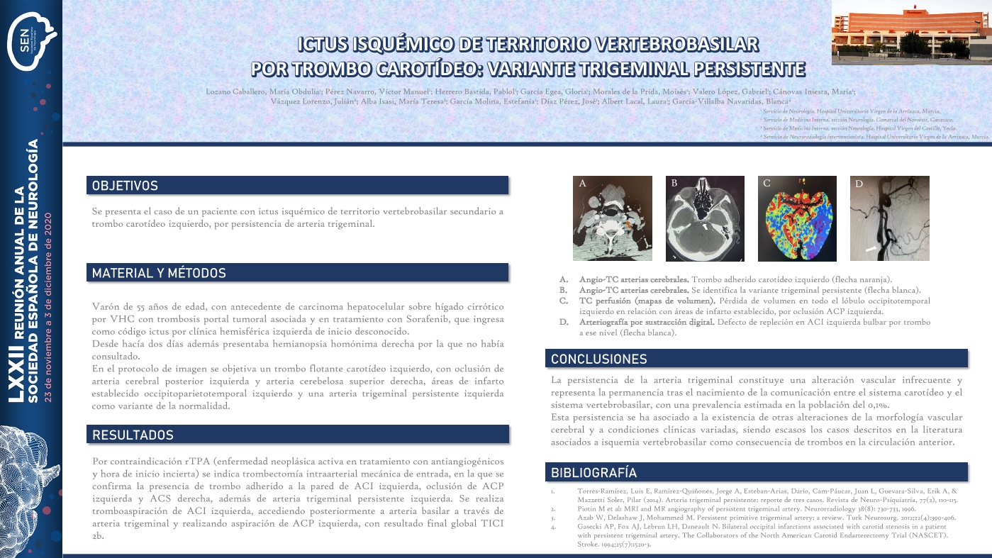 Ictus isquémico de territorio vertebrobasilar secundario a trombo carotídeo: variante trigeminal persistente.