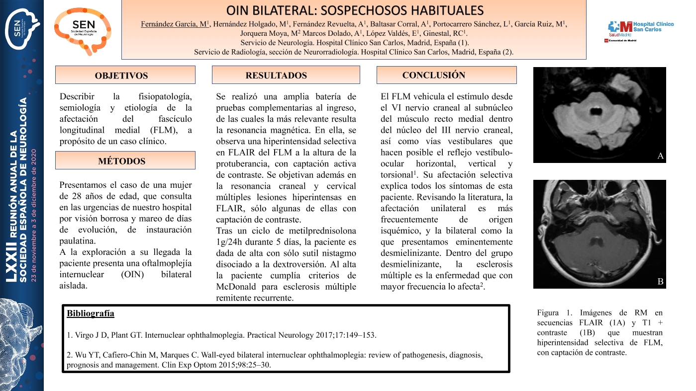 OIN bilateral: sospechosos habituales.