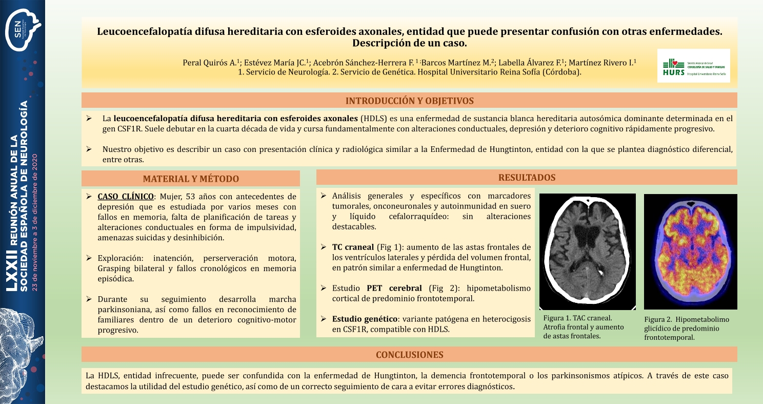 Leucoencefalopatía difusa hereditaria con esferoides axonales, entidad que puede presentar confusión con otras enfermedades. Descripción de un caso