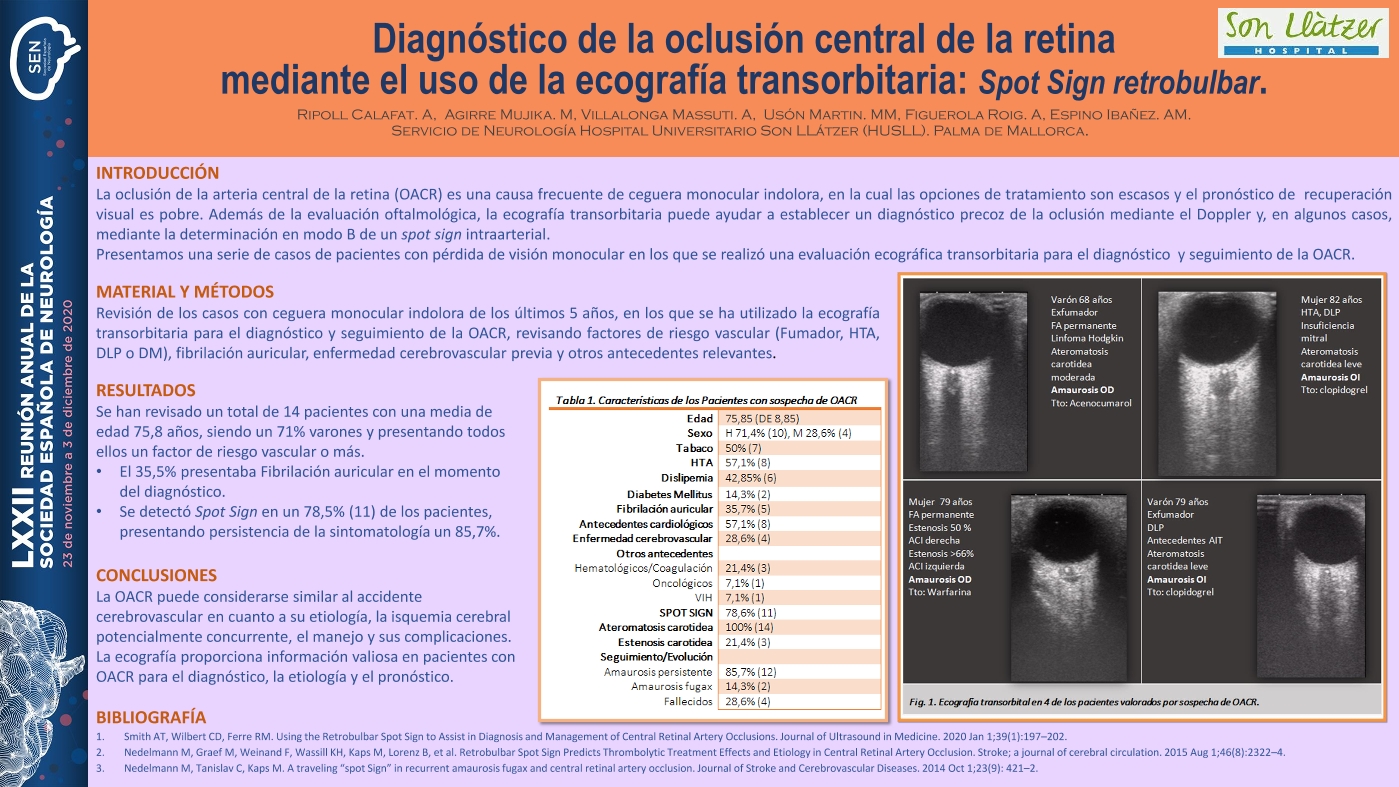 Diagnóstico de la oclusión de la arteria central de la retina mediante el uso de la ecografía transorbitaria: Spot Sign.