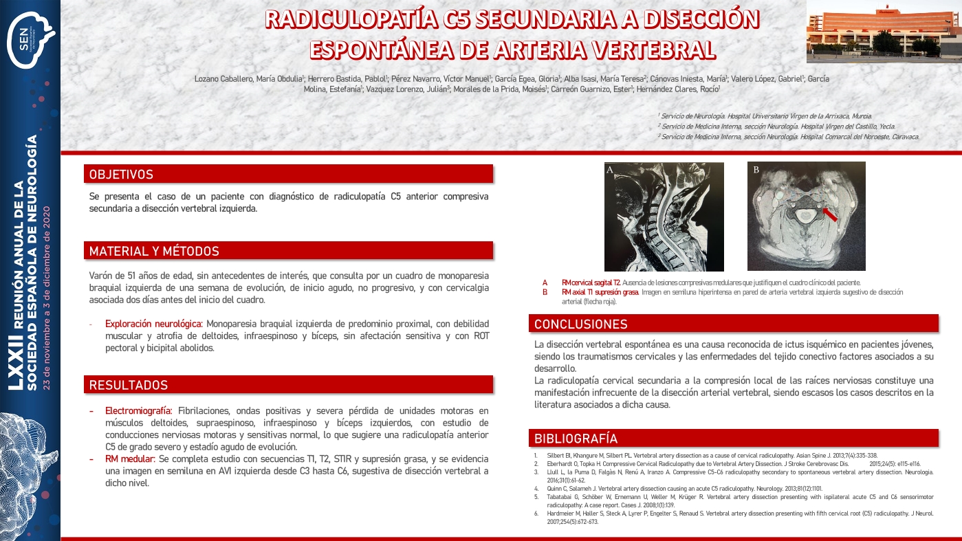 Radiculopatía C5 aislada secundaria a disección espontánea de arteria vertebral.