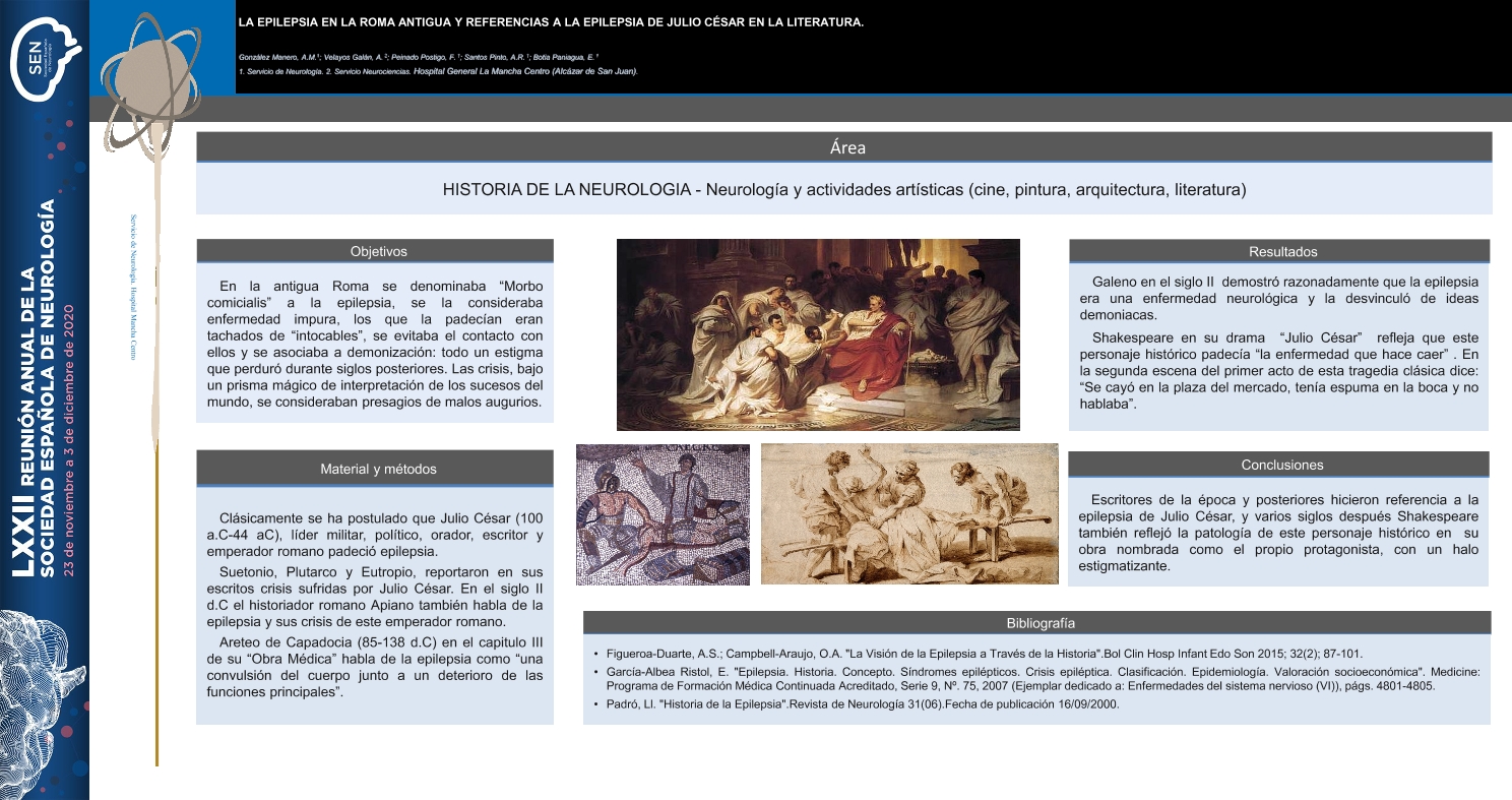 La epilepsia en la roma antigua y referencias a la epilepsia de julio césar en la literatura
