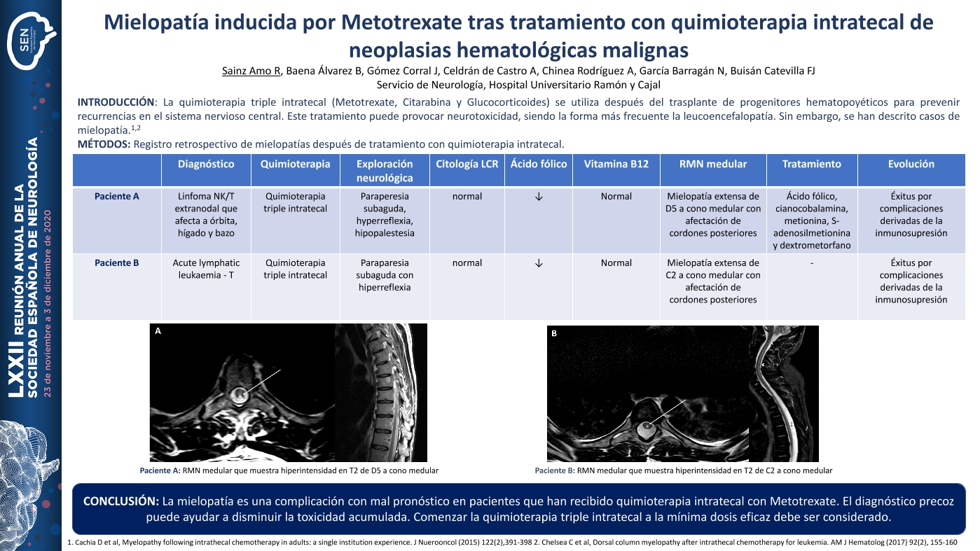 Mielopatía inducida por Metotrexate tras tratamiento con quimioterapia intratecal de neoplasias hematológicas malignas