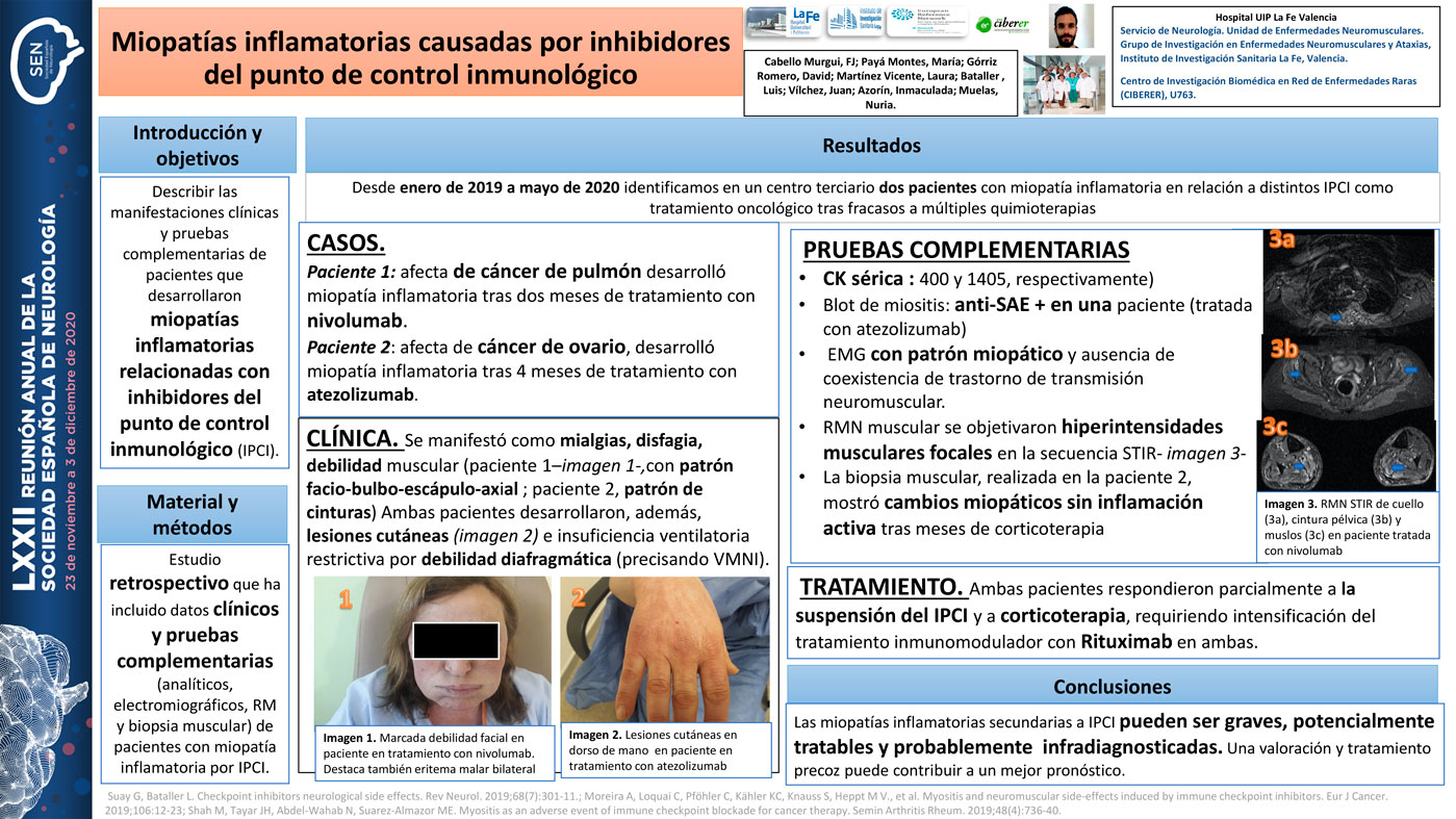 Miopatías inflamatorias causadas por inhibidores del punto de control inmunológico