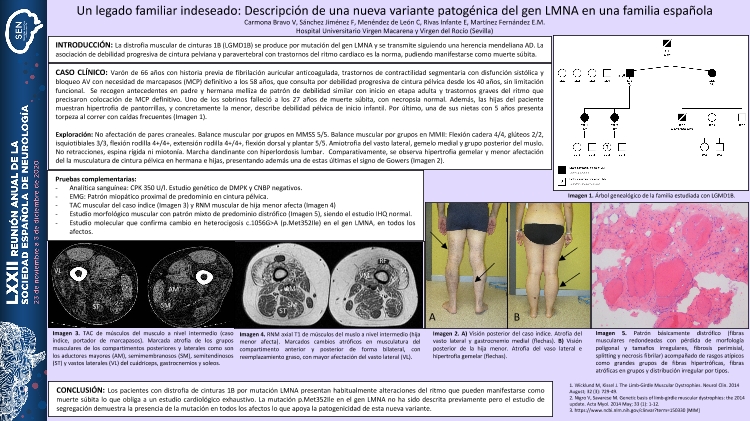 Un legado familiar indeseado: Descripción de una nueva variante patogénica del gen LMNA en una familia española