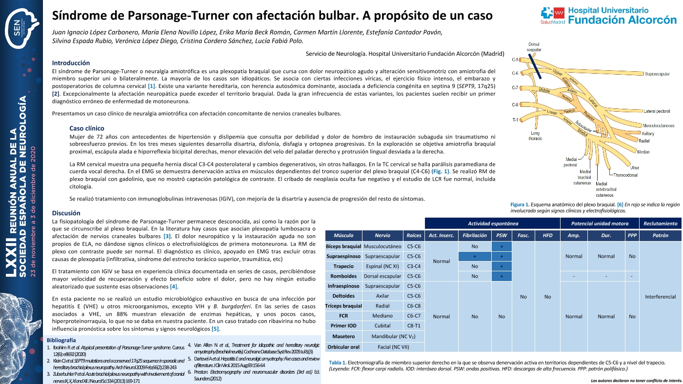 Síndrome de Parsonage-Turner con afectación bulbar. A propósito de un caso