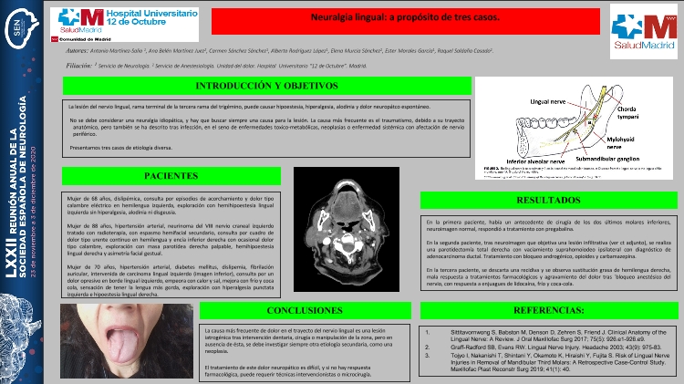 Neuralgia lingual: a propósito de tres casos.